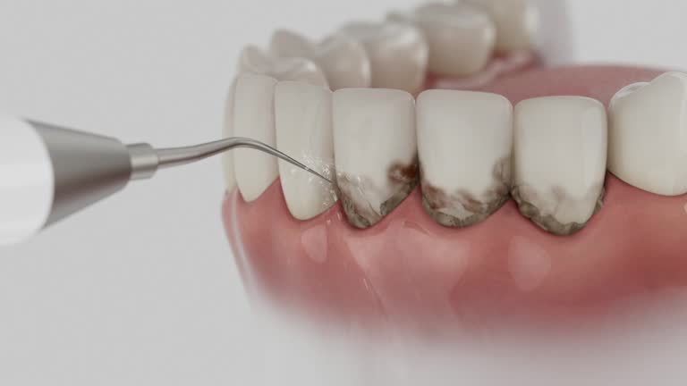 Reliable Teeth Cleaning And Checkup contractor in Wayne County County, NC by Dentist Open Now